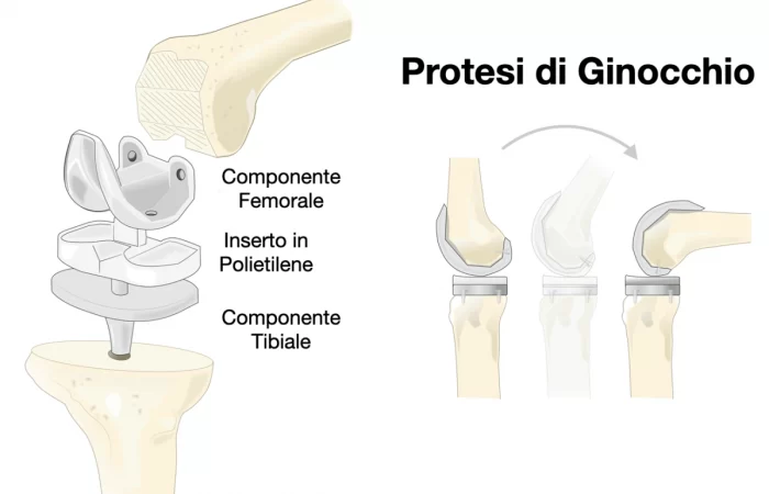 GINOCCHIO