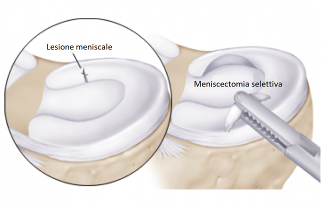 sport medicine