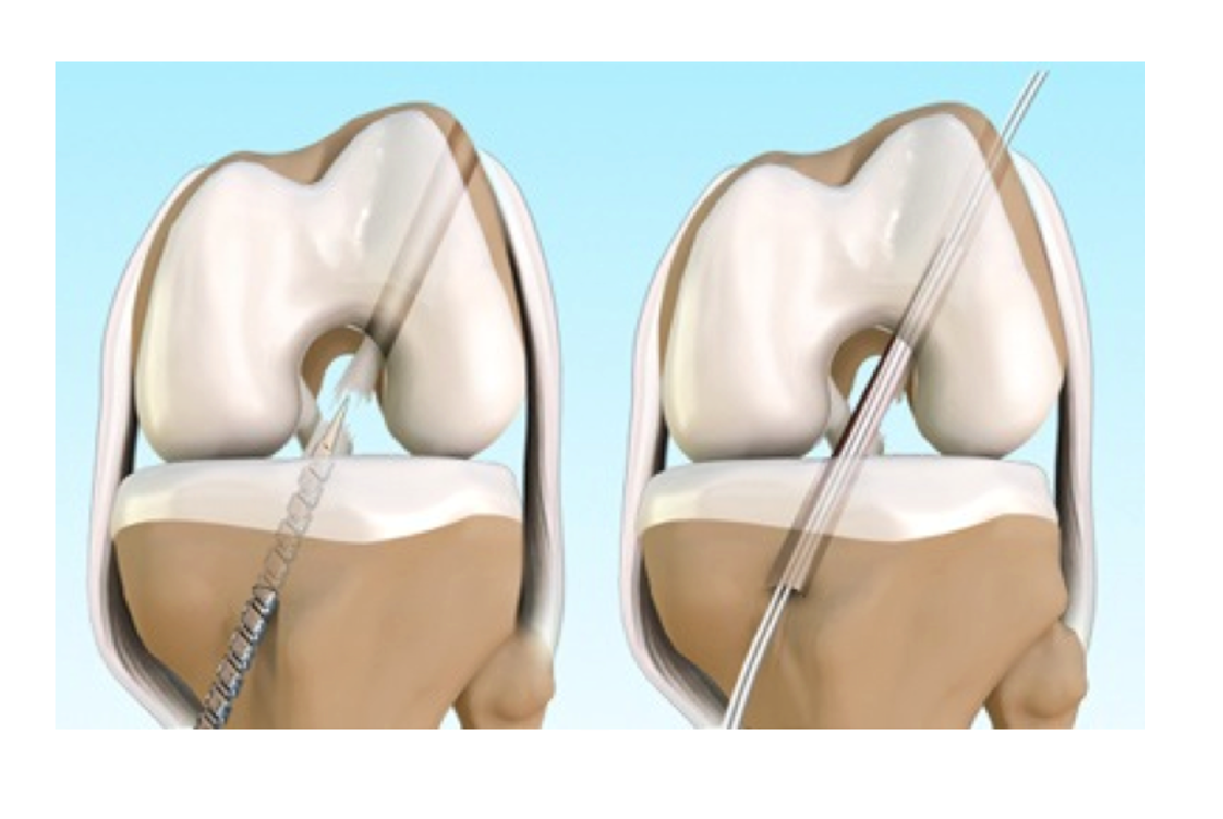Immagine 2022-04-12 123223 sports medicine