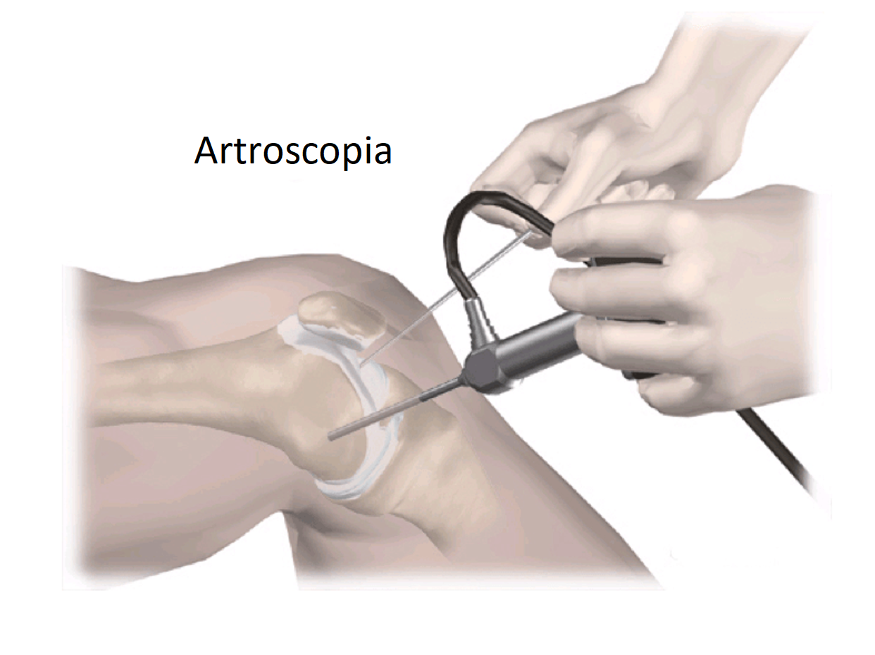 Immagine 2022-04-12 123325 sports medicine