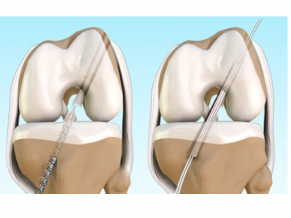 Immagine 2022-04-12 123223 sports medicine